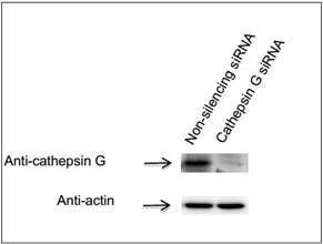 GenomONE™-Neo EX 仙臺(tái)病毒包膜轉(zhuǎn)染試劑