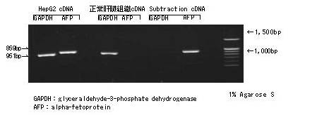 雙鏈特異性直接消化cDNA削減試劑盒